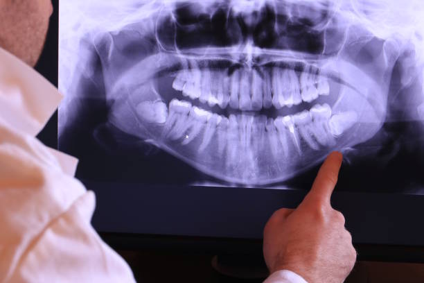 Best After-Hours Emergency Dentist in Roseville, MN