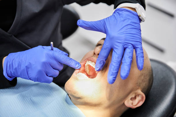 Best Emergency Root Canal Treatment in Roseville, MN