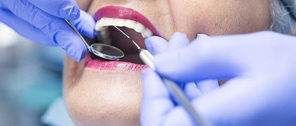 Best Emergency Wisdom Teeth Removal in Roseville, MN